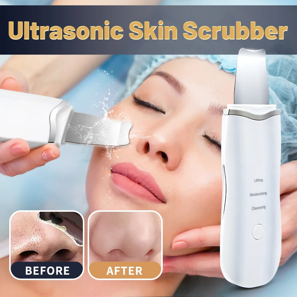 Ultrasonic Skin Scrubber & Blackhead Remover – Deep Pore Cleaner & Facial Ion Peeling Device